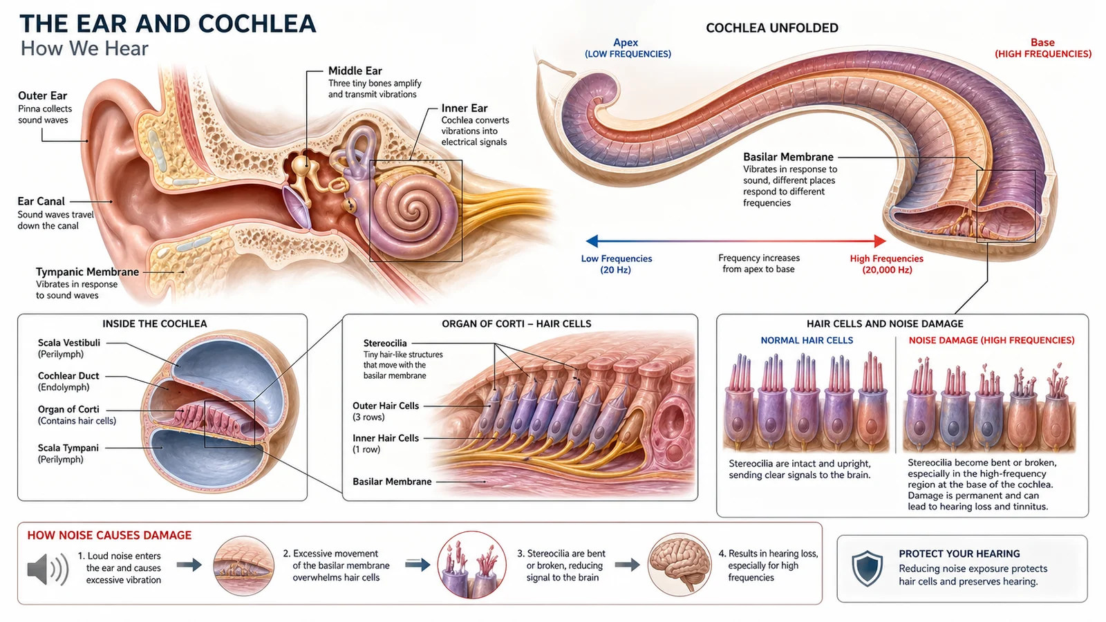 Photorealistic educational illustration showing the anatomy of the human ear with emphasis on the cochlea and inner ear hair cells &mdash; a cross-section diagram showing the cochlear structure with labeled stereocilia and hair cell rows, with a subtle indication of the high-frequency region most vulnerable to noise damage, clinical medical illustration style with clean background, warm educational color palette, no people